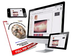 Pediatric Board Review, VAPP online and PDF Format
